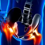 Why Your Hip Pain Might Not Be Coming from Your Hips!